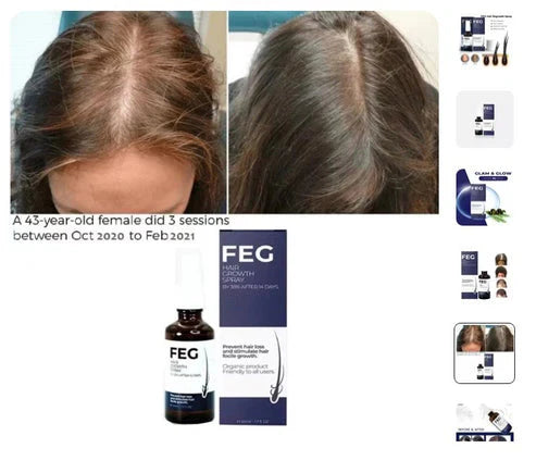 FEG Plus Hair Growth Spray